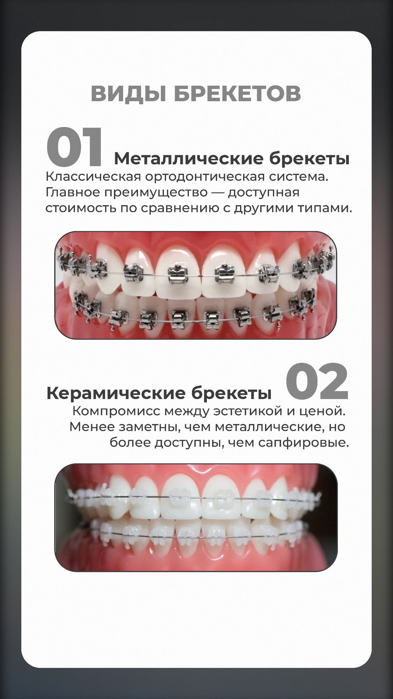 Брекеты — кейс