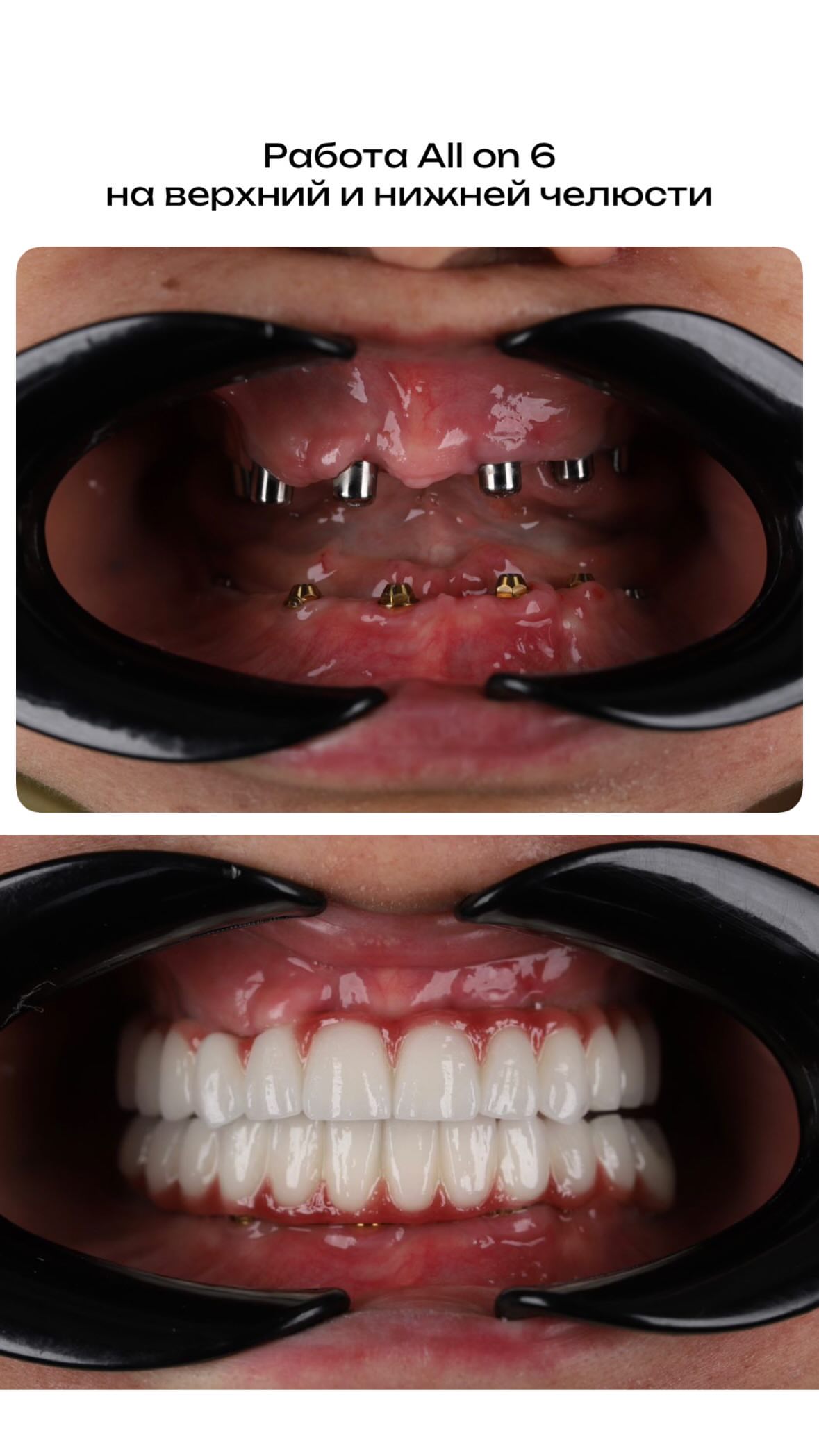 Команда ЭРDENT