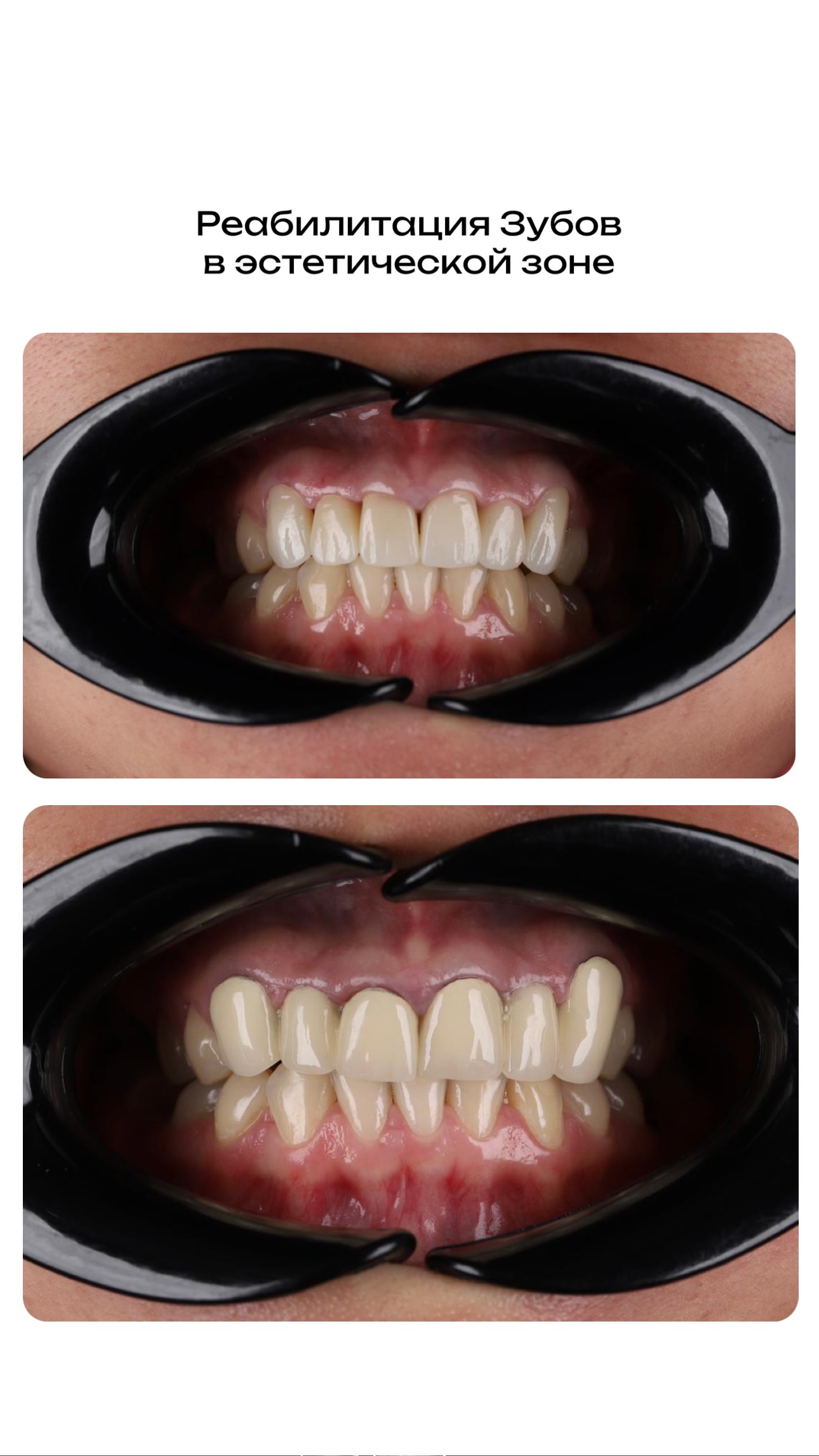 Команда ЭРDENT